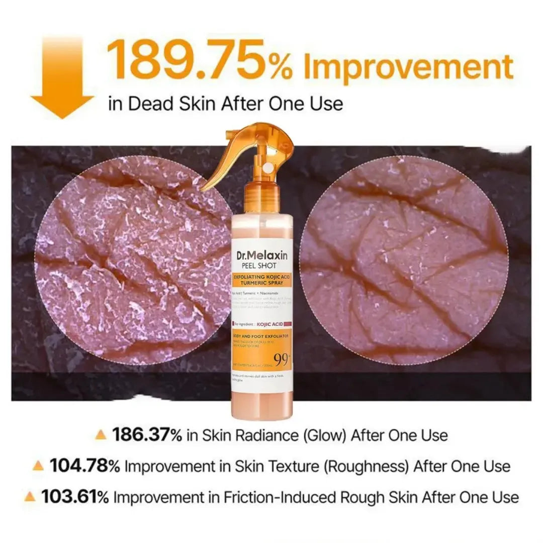 Dr. Melaxin Peel Shot- Body Keratin Care Acid Turmeric Spray with Gentle Body Brightening & Exfoliating Peeling Solution Korean Skincare, 6.76 fl.oz